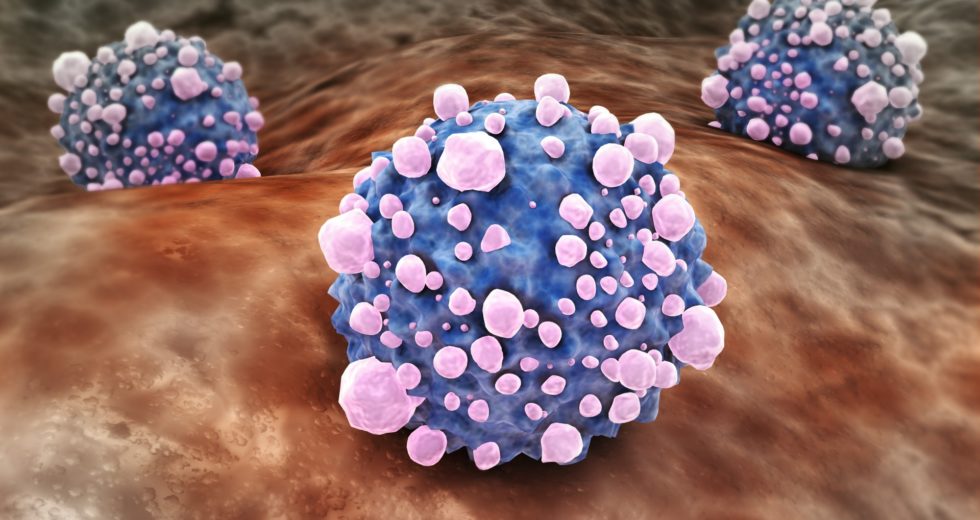 How Pancreatic Cancer Fuels Its Growth?