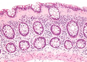 Give your body’s connective tissues the support they need with Collagenics