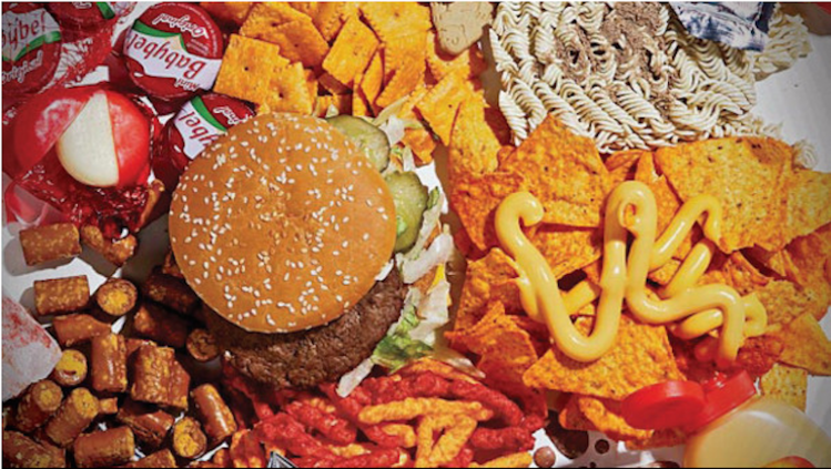 Western Diet Can Lead To Brain Damage