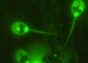 Parasite Changes Biology as We Know it — Some Forms of Life Can Thrive Without Breathing Oxygen