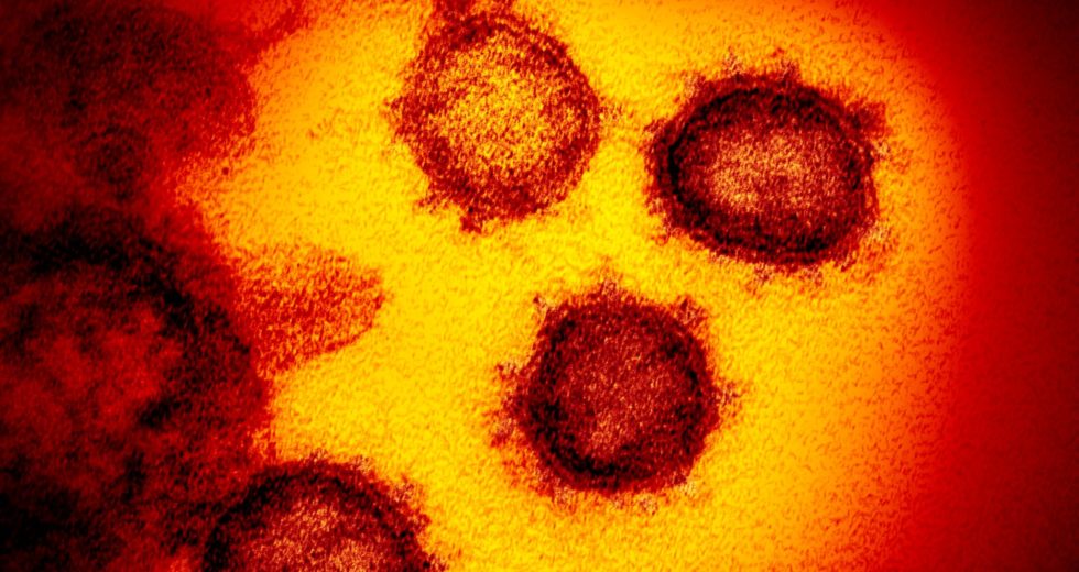 Health and Safety Tips for Seniors During Coronavirus Outbreak
