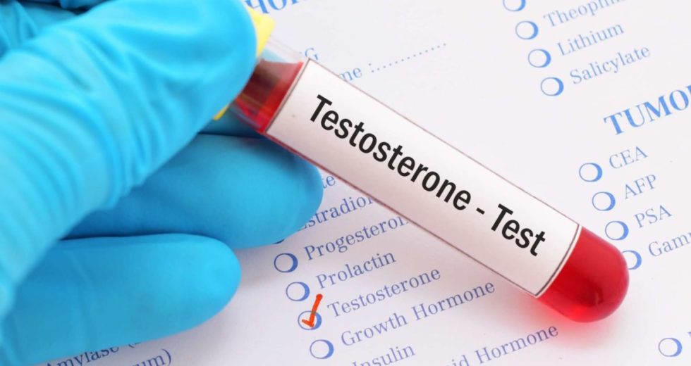Testosterone Doesn’t Govern Men’s Aggression and Sexuality