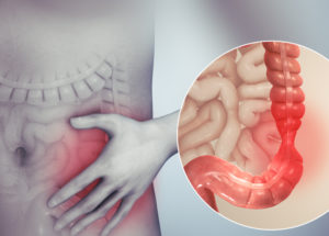 IBS And Weight Gain: What You Need To Know