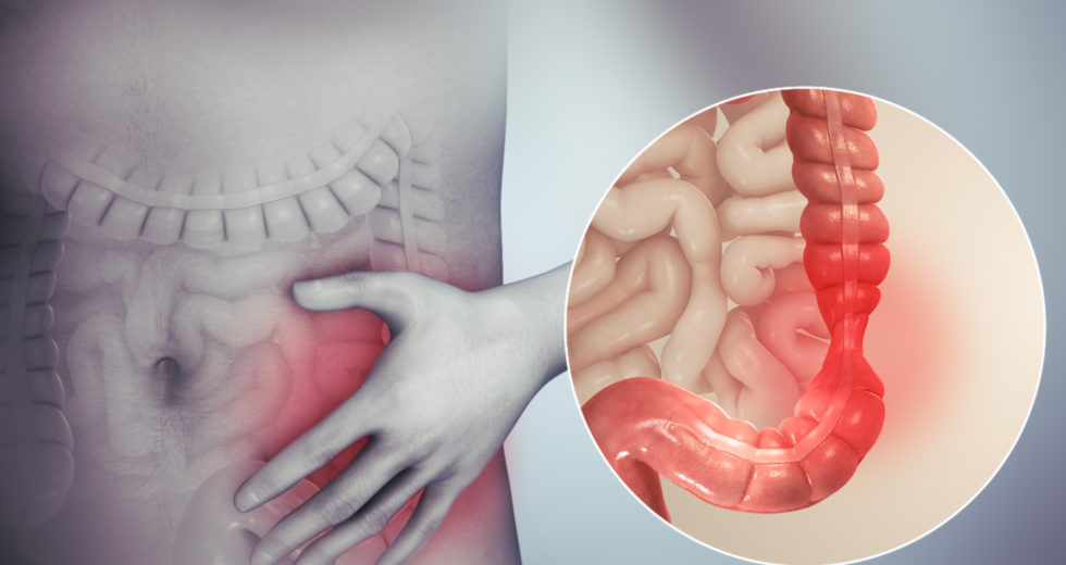 IBS And Weight Gain: What You Need To Know