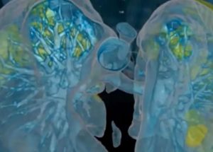 COVID-19 Treatment News: This Common Enzyme Could Protect Lungs