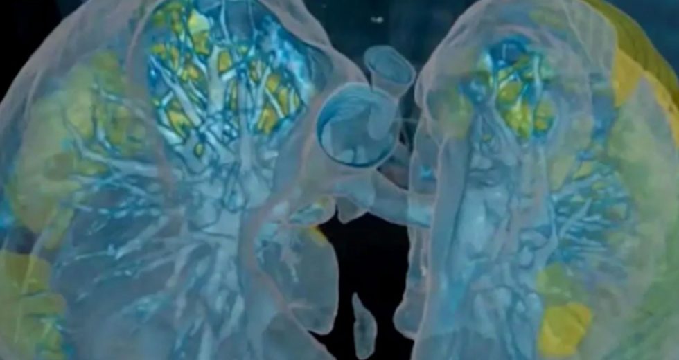 COVID-19 Treatment News: This Common Enzyme Could Protect Lungs