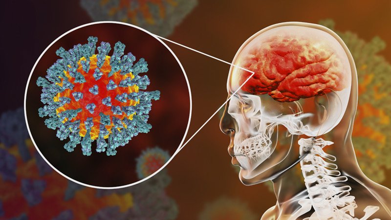 COVID-19 Disturbing Effects On The Brain Revealed