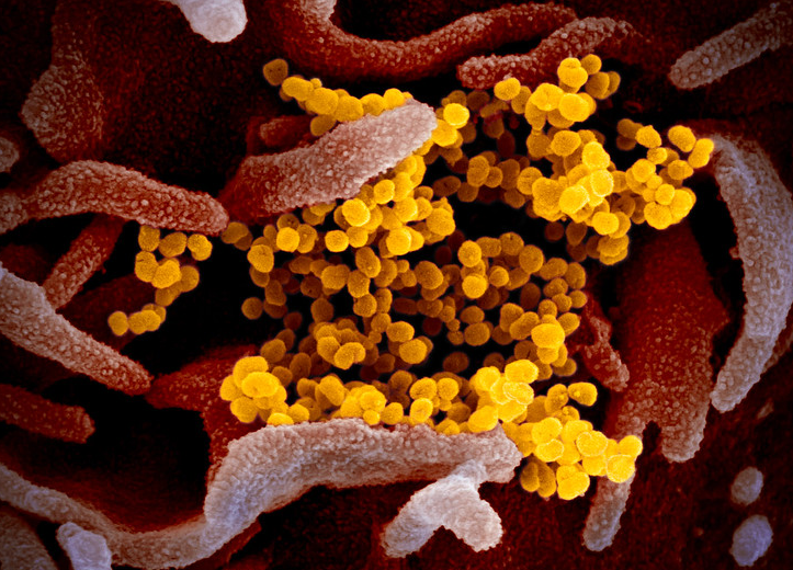 Infected Covid-19 Individuals Now Have to Isolate for 10 Days, not 7