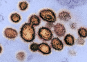 WHO Decides to Consider Airborne Transmission for the New Coronavirus