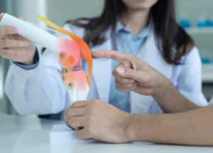 17 Things To Know Before Joint Replacement Surgery