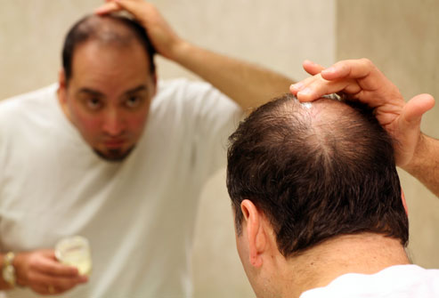 Hair loss isn’t just your mother’s father’s fault