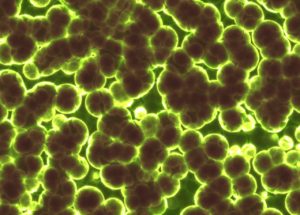 Scientists Managed To Watch Storms Of Microbes Brew Inside Cells Via Weather Radar Tech