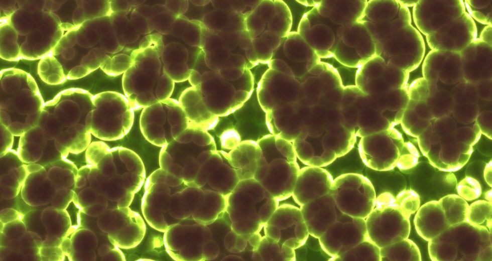 Scientists Managed To Watch Storms Of Microbes Brew Inside Cells Via Weather Radar Tech
