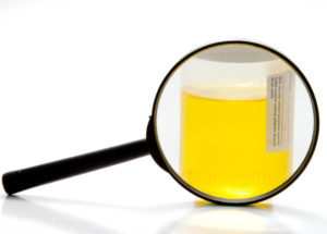 Essential Tips to Beat the Urine Drug Test