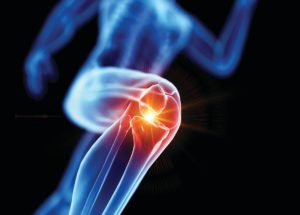 How to Naturally Reduce Inflammation and Feel Healthier