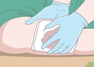 How to Make and Use A Tourniquet