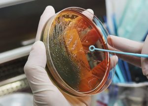 Lab-Grown Cancer Cells Developed Different From Human Ones, Study Shows