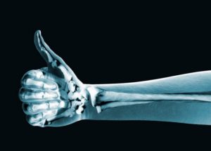 Prevent Your Bones From Ageing By Exercising Regularly