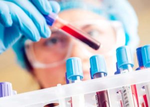 Detecting Pancreatic Cancer With Just a Blood Test – It’s Likely Months Away From Implementation
