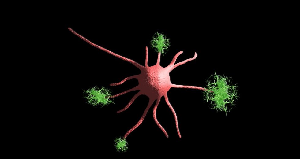 Breaking The Biggest Myths Around Alzheimer’s Disease