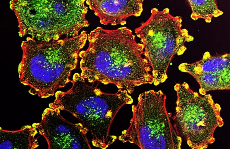 Women Worldwide Could Benefit from Effective Ovarian Cancer Treatment