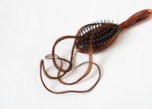 What Can You Do When You’re Experiencing Hair Loss?