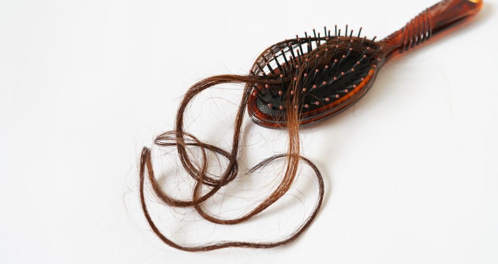 What Can You Do When You’re Experiencing Hair Loss?