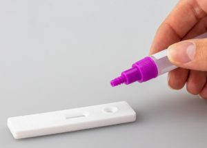 Covid 19 PCR And Antigen Tests – Reasons For Different Results