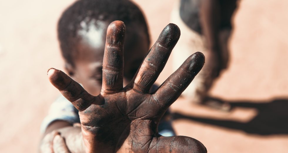 First Wild Polio Case Confirmed In Africa After More Than Five Years