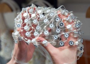 Man’s Brain Monitored as He Died – Finally Proves We See Our Lives Flash before Our Eyes during Our Final Moments?