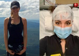 Experts Warn COVID-19 Could Lead to a New Epidemic of Chronic Fatigue Syndrome, a Debilitating but Under-Researched Illness!