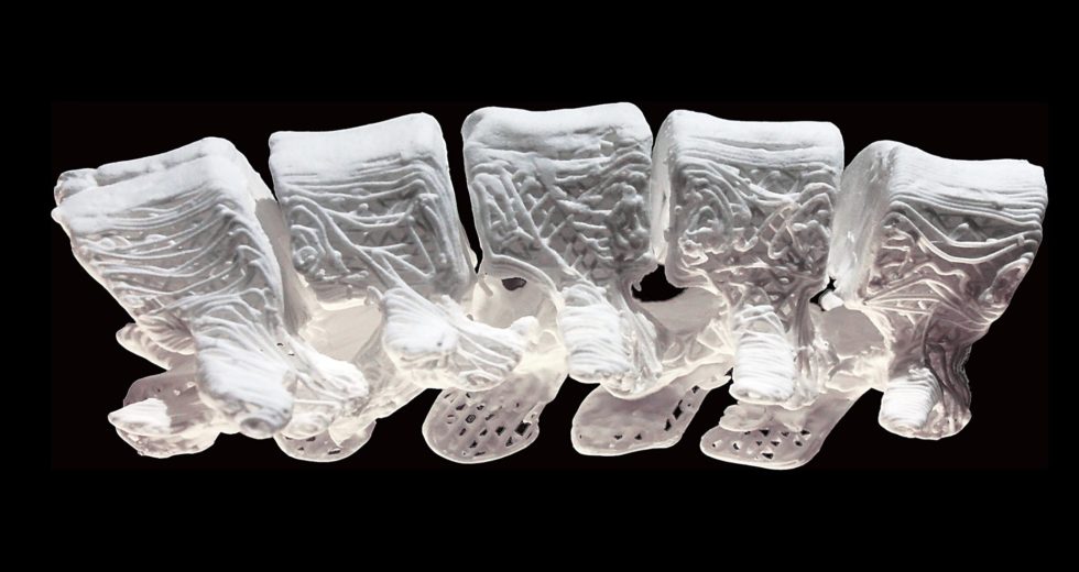 New Technology Allows 3 Paralyzed Men to Walk Again!