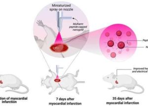 New Research Finds that Tiny Gold Particles Can Treat Heart Disease