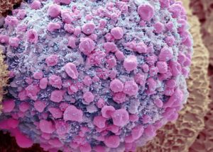 Coronavirus “Ghosts” Lingering in the Gut Could Be the Cause for Long COVID!