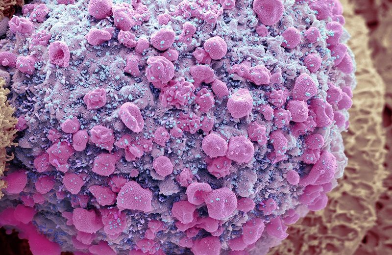 Coronavirus “Ghosts” Lingering in the Gut Could Be the Cause for Long COVID!