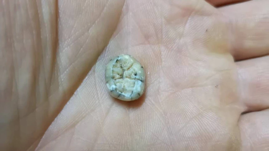 Tooth Found in Laos Cave May Reveal Unknown Phase of Human Evolution