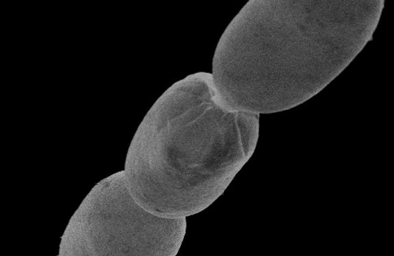 Scientists Discover the Largest Bacteria Ever Found – You Can See It With the Naked Eye