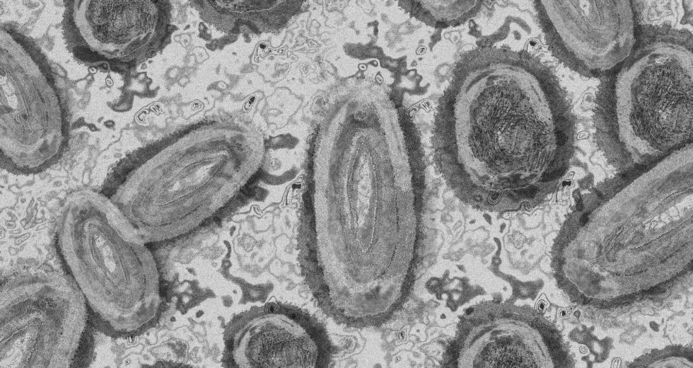 “Monkeypox” to Receive a New Name After Scientists Say It’s Offensive