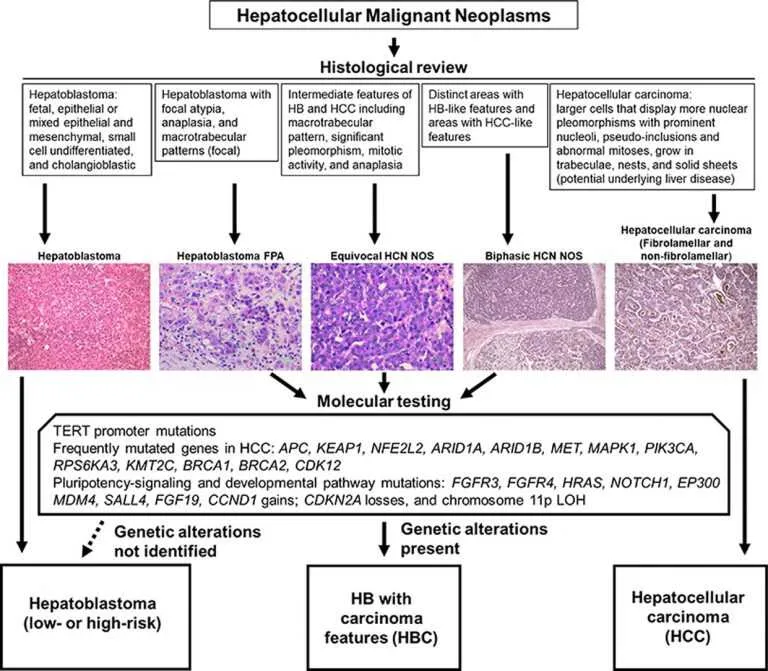 Credit: Image courtesy of the authors/Journal of Hepatology