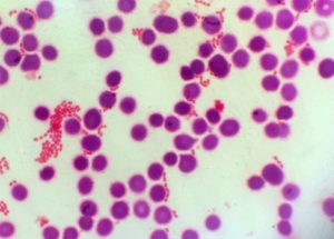 Study Finally Learns More About Sepsis and How it Causes Cell Death