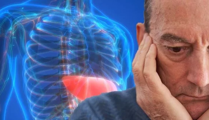 Non-Alcoholic Fatty Liver Disease Linked to Serious Neurological Issues in New Study