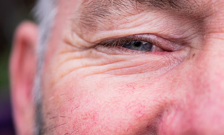 Diabetes and Eye Problems: How Diabetes Affects Your Eyes?