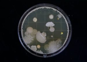 Some Gut Microbes Are More Efficient At Gathering Energy Than Others