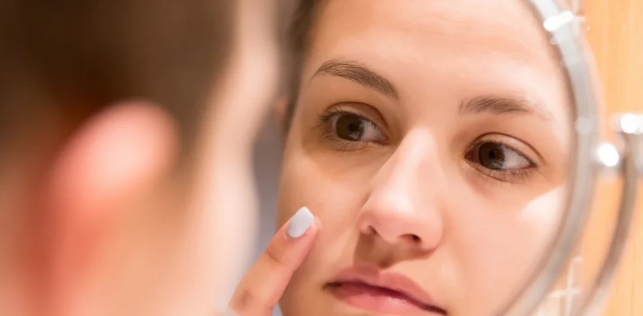 Never Pop These Small Hard Bumps on Your Skin – Here’s Why!