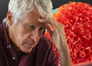 Fatigue Is the Biggest Cancer Symptom Most People Ignore until it’s too Late!