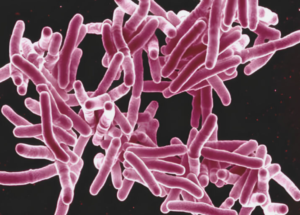 Woman Faces Jail Time after Ignoring Court Order to Isolate and Treat Active TB for a Year