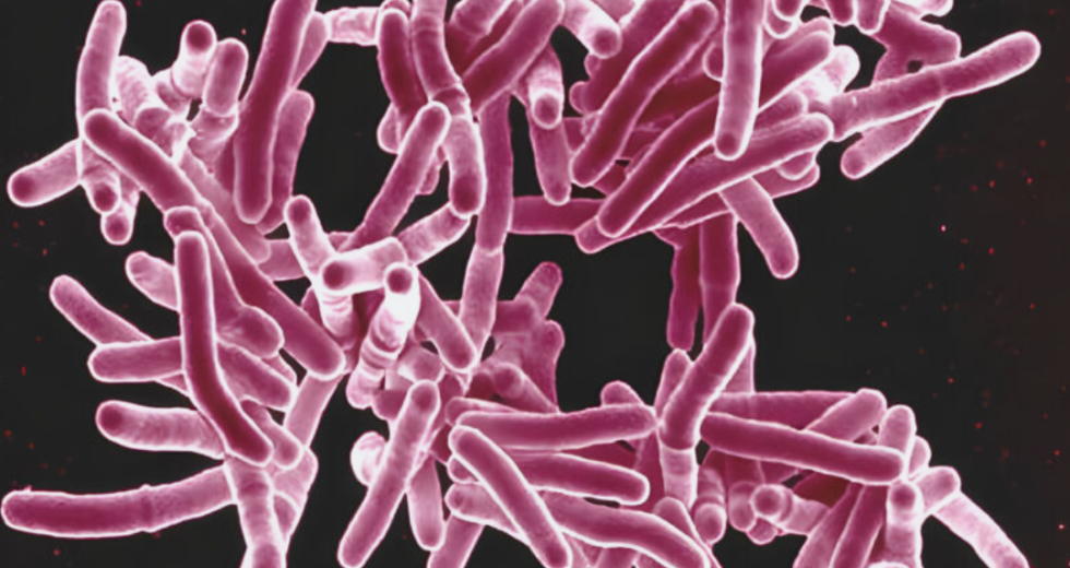 Woman Faces Jail Time after Ignoring Court Order to Isolate and Treat Active TB for a Year