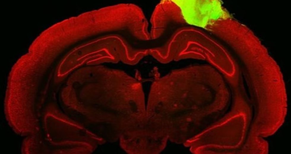 Scientists Find Possible Blindness Cure By Transplanting Human Brain Piece into Rat Brain