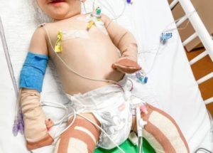 1-Year-Old Gets Legs Amputated after Contracting Scary Illness on the Rise among Children