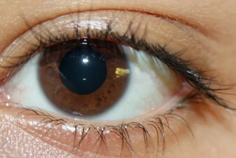 Study Finds a New Prevention Strategy for Blindness